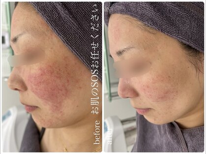 モアナ(moana)の写真