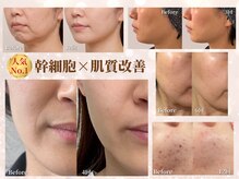 ベモーレ 谷町九丁目 上本町