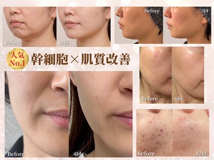 ベモーレ 谷町九丁目 上本町の写真