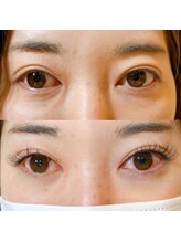 アディクト 恵比寿店(ADDICT)/エクステBeforeとafter