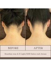 ルディ 阿波座店(rudi)/うなじ ワックス＆光脱毛