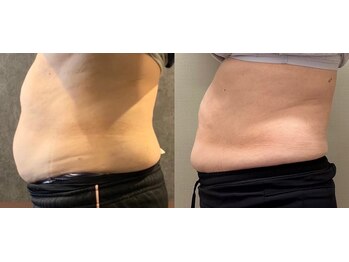 ココア(CoCoa)/トレーニング×最新マシン