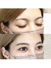 アイリー(IRIE)/ハリウッドブロウリフト