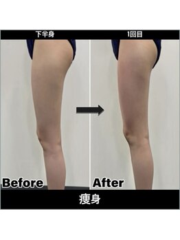 Sスタイルスタジオ 福岡天神/下半身そう身1回目のお客様