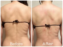 ユーキャン(You Can)/本格痩身