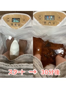 エルプラス(L+)/フッドデトックス 1