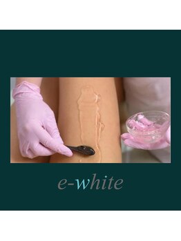 イーホワイト(e-white)/施術写真