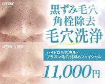 ジュエルボンド(Jewel Bond)