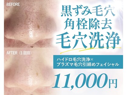 ジュエルボンド(Jewel Bond)の写真