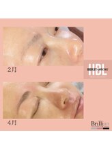 ブリリアン/ハリウッドブロウリフト　眉毛