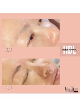 ブリリアン/ハリウッドブロウリフト 眉毛