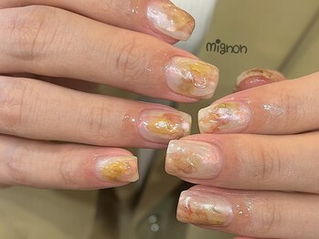 ミニョン(mignon)/mignon定額コース