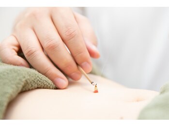 スクナビコナ鍼灸院/お灸の様子