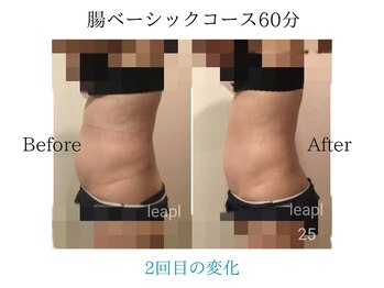 リープル(Leapl)/【腸もみ】腸もみ後の変化写真