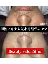 シン(Shin)/黒ずみケア