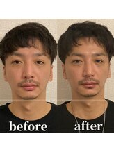 ロータス ビューティー(LOTUS Beauty)/小顔/むくみ解消