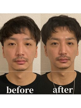 ロータス ビューティー(LOTUS Beauty)/小顔/むくみ解消