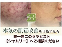 シャムリー 並木坂(Syamry)
