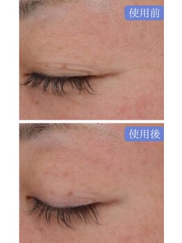 ワイアンドワイ(Y&Y)/リポソーム美容液