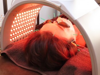 タピヨン 渋谷鍼療院(Tapiyon)の写真/【顎関節・食いしばり/光LED美容鍼】顎関節に効かせて、エラ張り・左右非対称・歪み改善。ツヤ肌に♪