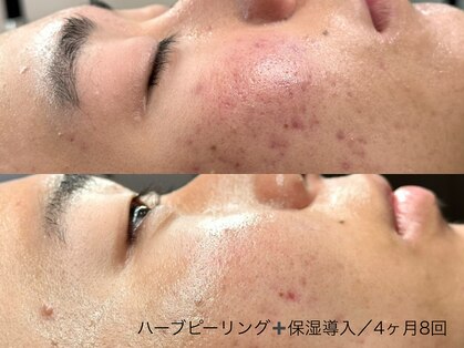 オンリィケア 近大前(ONLY CARE)の写真