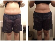 ラベルヴィ(La belle vie)/結果重視・痩身エステのお客様