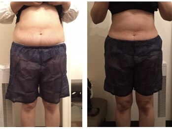 ラベルヴィ(La belle vie)/結果重視・痩身エステのお客様