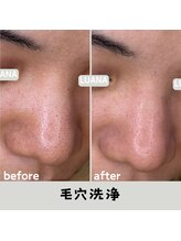 ルアナ 北谷店/毛穴洗浄毛穴ケア 《沖縄/北谷》