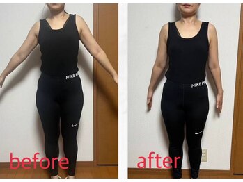 リリィ(RIRY)/【BODYビフォーアフター】