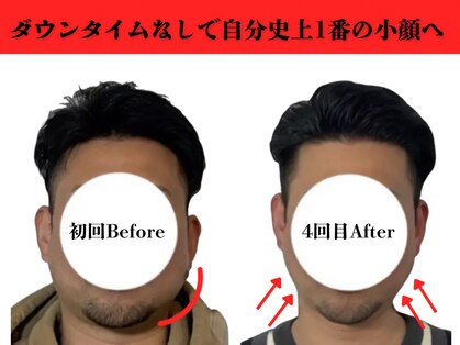 アロエベル(aloe Belle)の写真