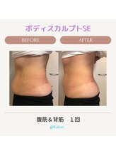 カロン(Kalon)/ボディスカルプトでくびれ美人♪