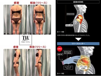 トワ 恵比寿(TOWA)/リリースカッターって？(恵比寿)