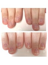 シープラス/深爪さん・ジェル無で自爪育成