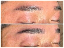 エステティック ティアリィ エアポートウォーク名古屋店(TiARY)/メンズ ハリウッドブロウリフト