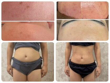 ボディキュア グランド(Body cure Grand)の写真