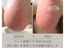 6000円/フット角質ケア
