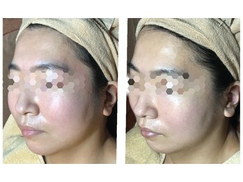 リアン(凛晏)/ビフォーアフター