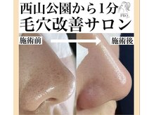 ピュール 鯖江店(PUR)の雰囲気（完全個室で周りを気にせず優雅に！【毛穴エステ】も大人気◎）