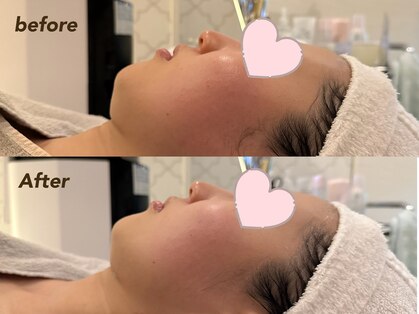 メナードフェイシャルサロン 丸の内ヒルズの写真