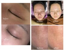 くすみ・乾燥・毛穴・ごわつき・ざらつきが気になる肌を整える☆