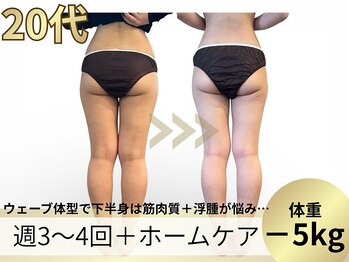 ヨサパーク ア モード ミオ 柴又店(YOSA PARK A modo mio)/ウェーブ体型だけど脱下半身太り