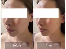 Beauty Salon Leyra【バストアップ/痩身/小顔/筋膜リリース】【4/22 NEWOPEN(予定)】/