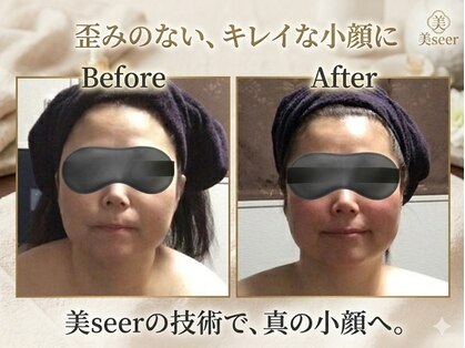 小顔アンドエイジングケア専門店 ビゼ(美sser)の写真