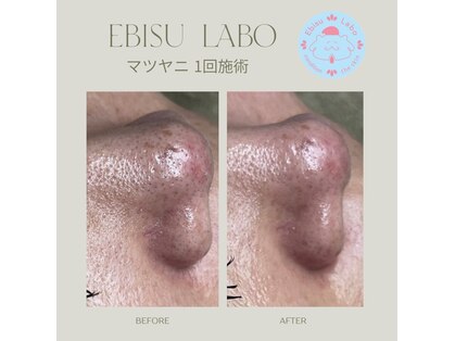 エビスラボ(Ebisu Labo)の写真
