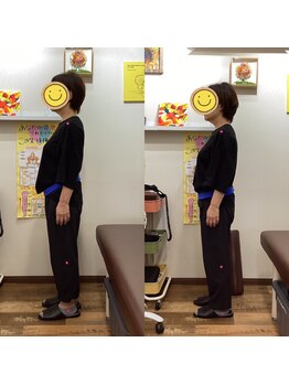 ヒデ整体院(Hide整体院)/腰痛　反り腰改善　姿勢骨盤矯正