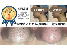 シェノン(Chainon)
