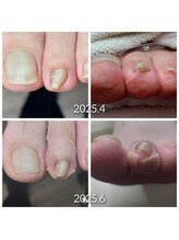 爪切り屋 足楽/