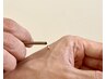 皮膚のお悩みに【東洋鍼灸】50分