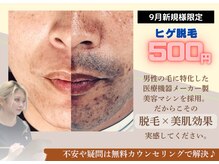 フォー(the 4)