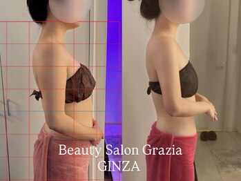 グラツィア 銀座(Grazia)/8回【 ブライダルエステ整体 】